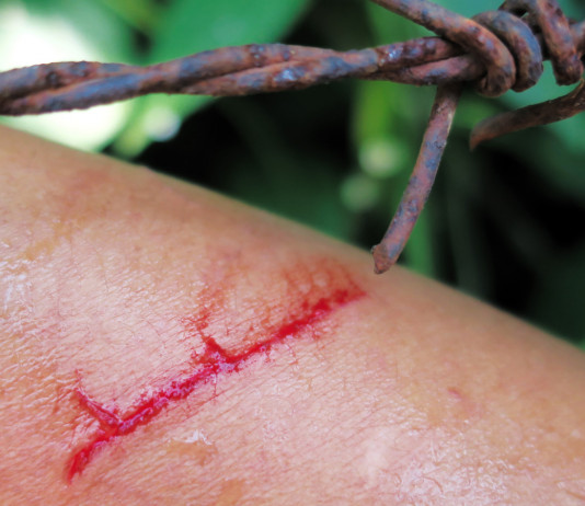 Ferite a caccia: attenzione al tetano Ferite a caccia: attenzione al tetano